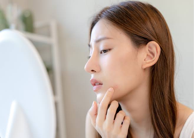 Stress Ảnh Hưởng Đến Làn Da Và Vóc Dáng Như Thế Nào